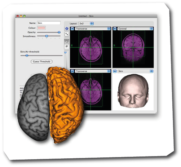 Brainsight Neuronavigation System | Brainbox